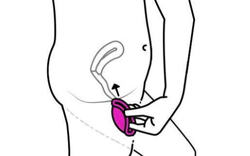 Comment insérer le diaphragme