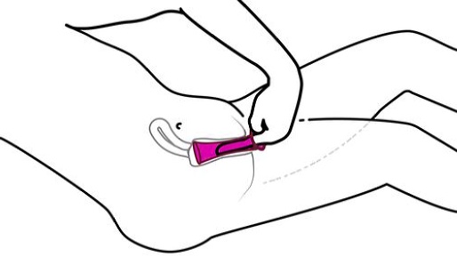 utilisation anale du préservatif interne