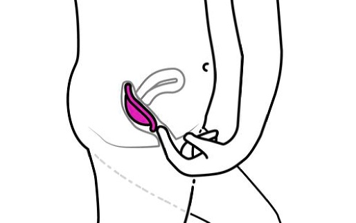 Comment retirer le diaphragme