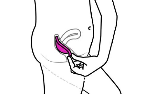 Retirer le diaphragme